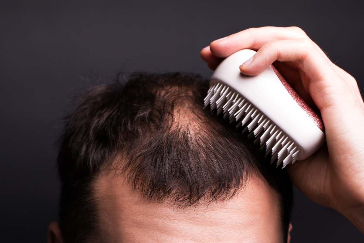Queda de Cabelo
